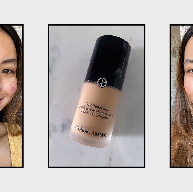 This A-List Approved Foundation Is Brilliant For Disguising Acne Scars