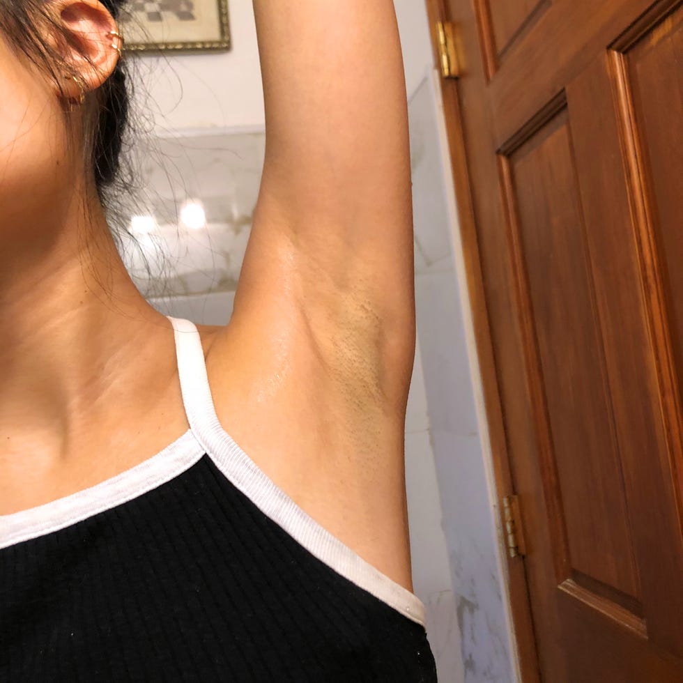 My underarm after using Billie.