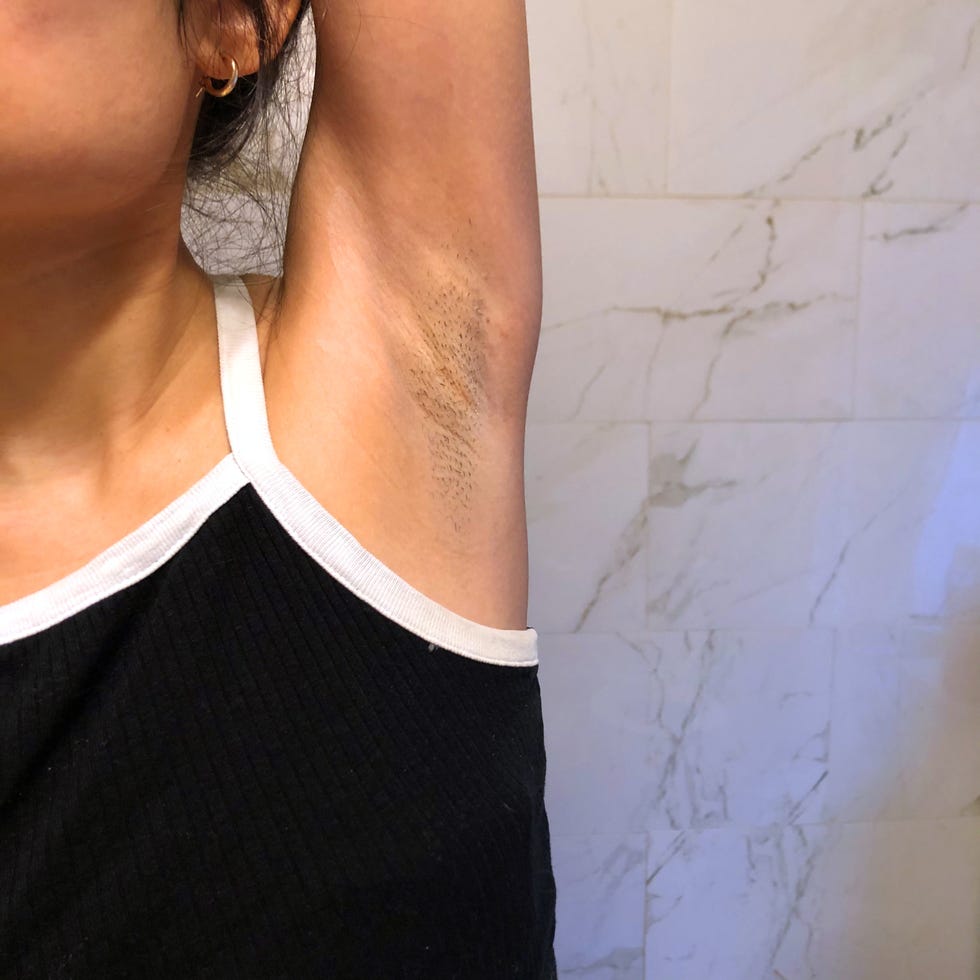 My armpit before using Billie.