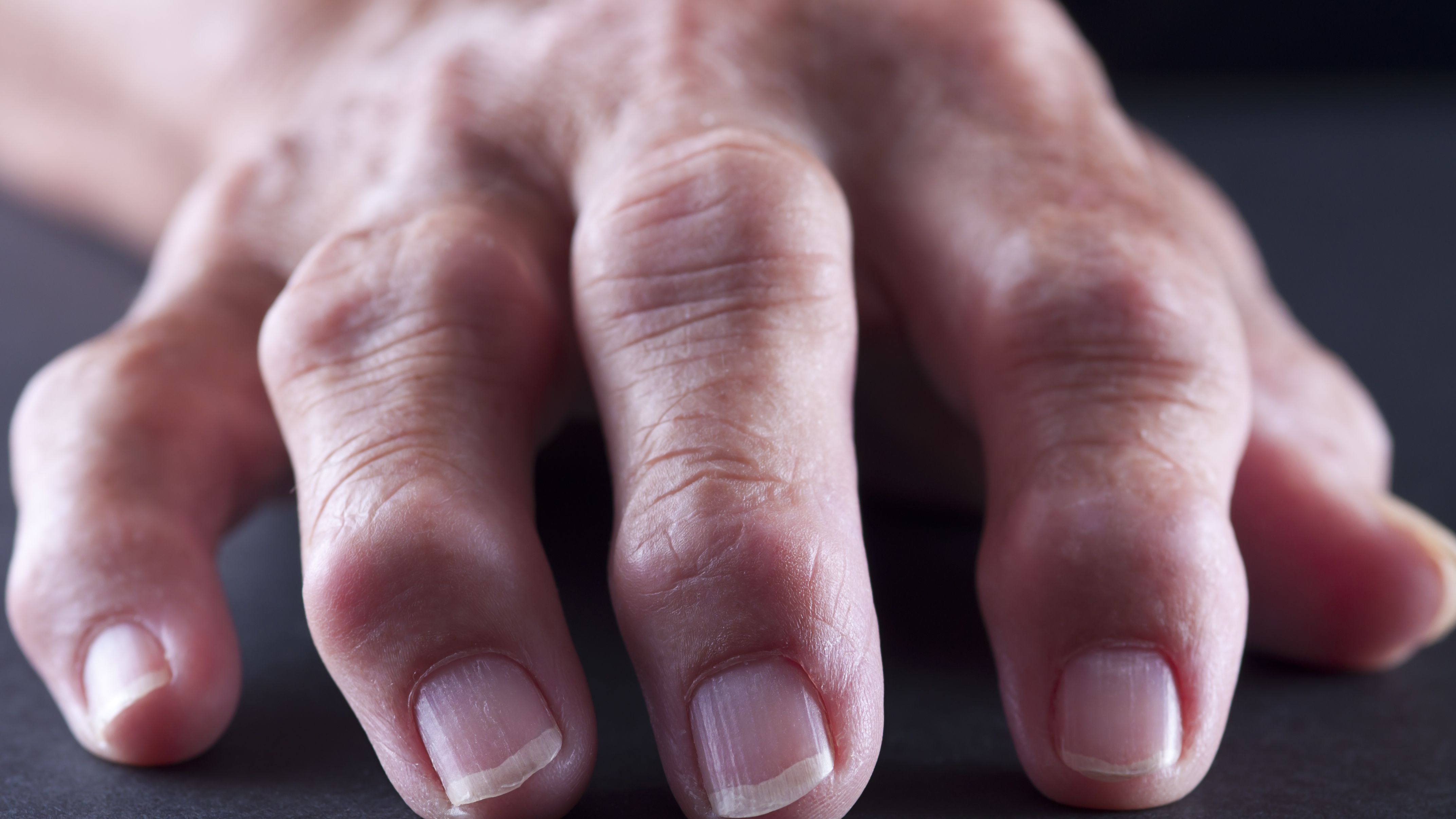 Swollen Fingers: Causes, Treatment, Risks