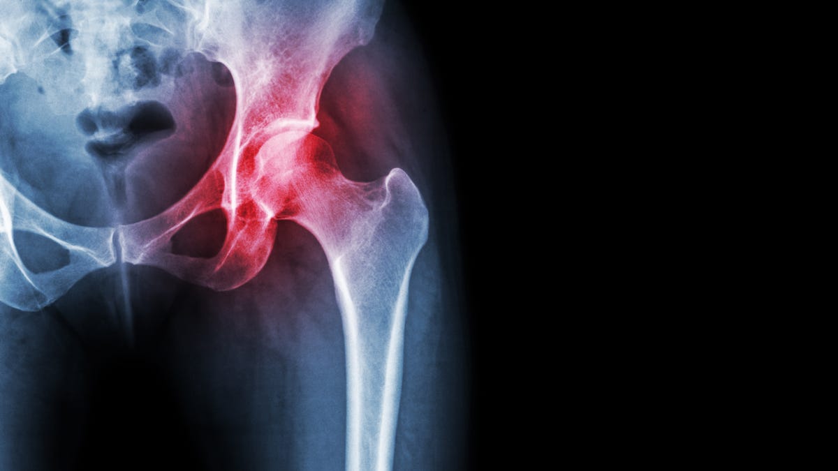 How Chiropractic Care Can Help With Hip Pain Relief