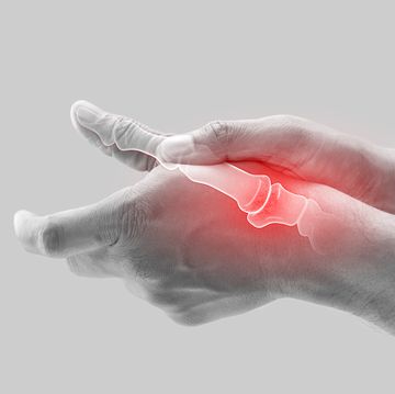arthritis of the finger and thumb joint