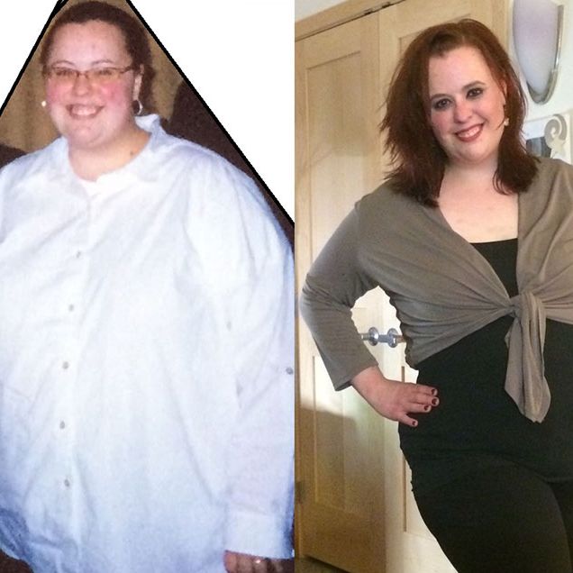 weight loss surgery wasn't what she thought it would be