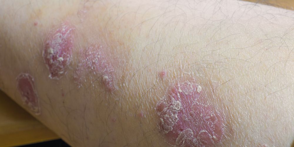 8 Skin Issues That Could Signal Something's Wrong with Your Health ...