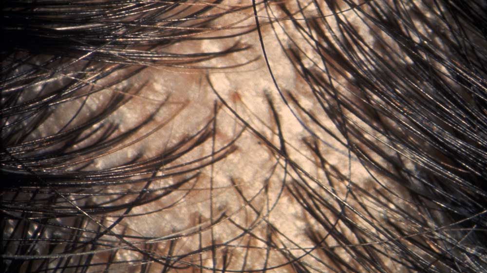8 Ways To Tell If Your Hair Is Thinning Before It's Too Late | Prevention