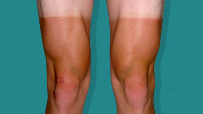 The Care and Keeping of Your Cycling Tan Lines