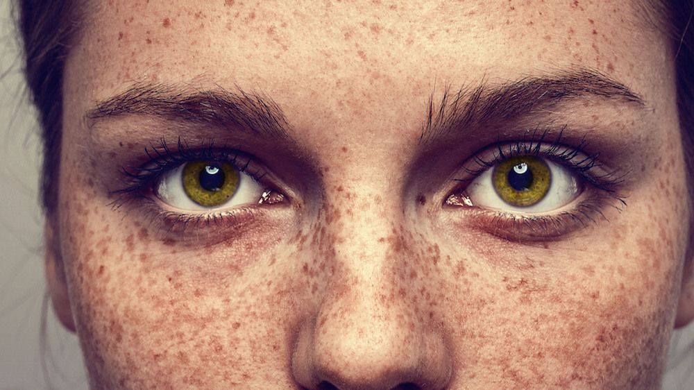 What All Women With Freckles Need To