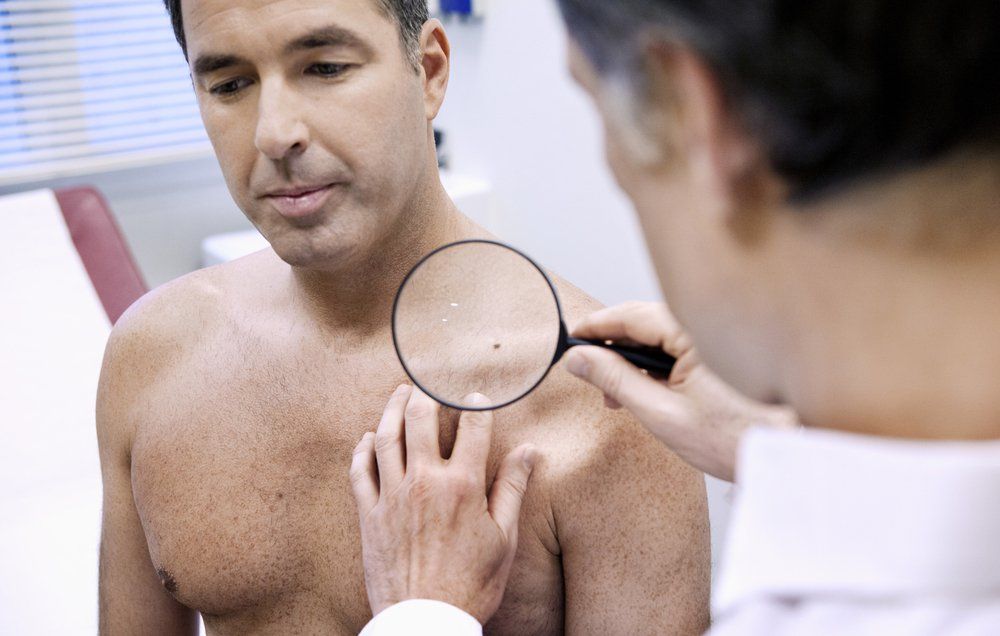 What Does a Hairy Mole Mean? | Men's Health