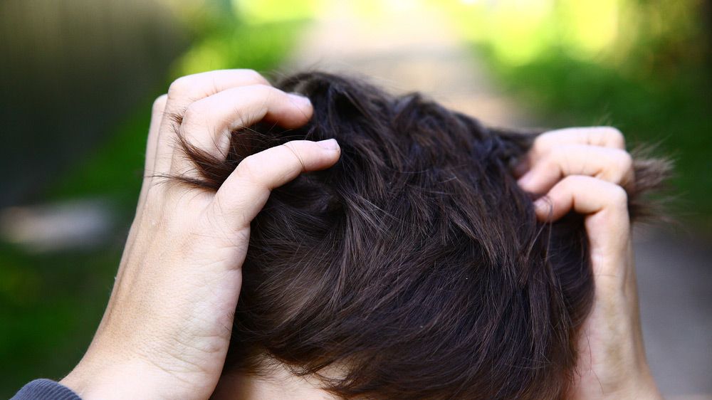 How to Get Rid Of Head Lice | Men's Health