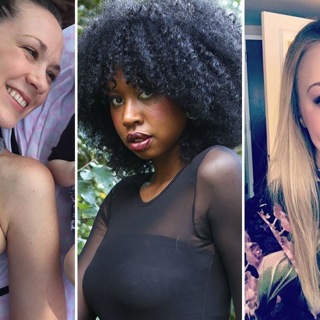 3 Women Explain What It's Really Like to Live With Psoriasis