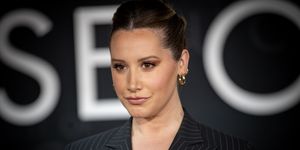 ashley tisdale reveals her struggles with hair loss and alopecia