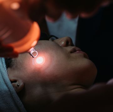 ultraclear why cold lasers are the hottest new skin treatment