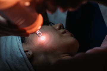 ultraclear why cold lasers are the hottest new skin treatment