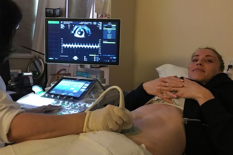 Astrid Swan Ultrasound