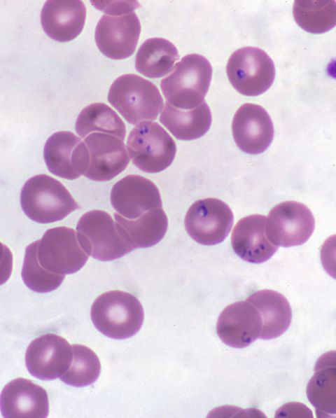 babesia microti in human erythrocytes