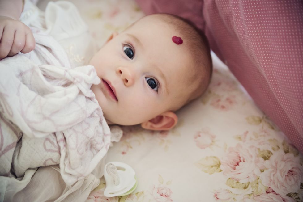 bebé niña con un pequeño hemangioma en la frente