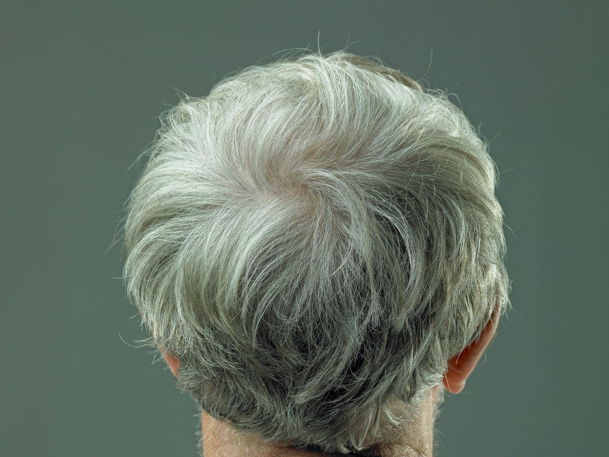 Link Between Stuck Stem Cells and Graying Hair: A Study’s Insights