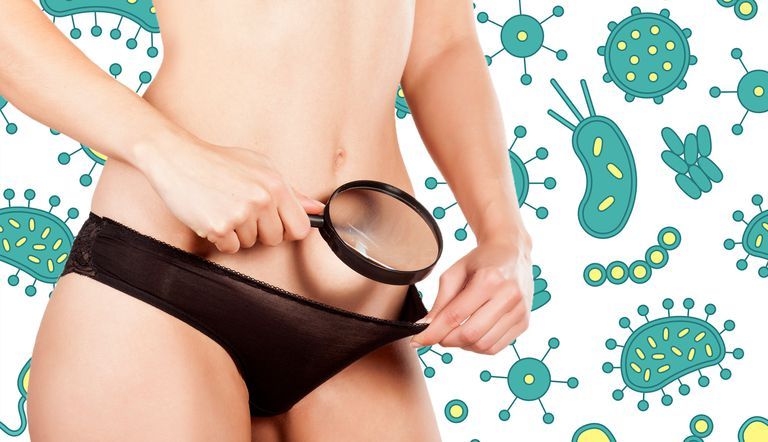 What Is Bacterial Vaginosis? BV Symptoms, Causes, Treatments & Prevention