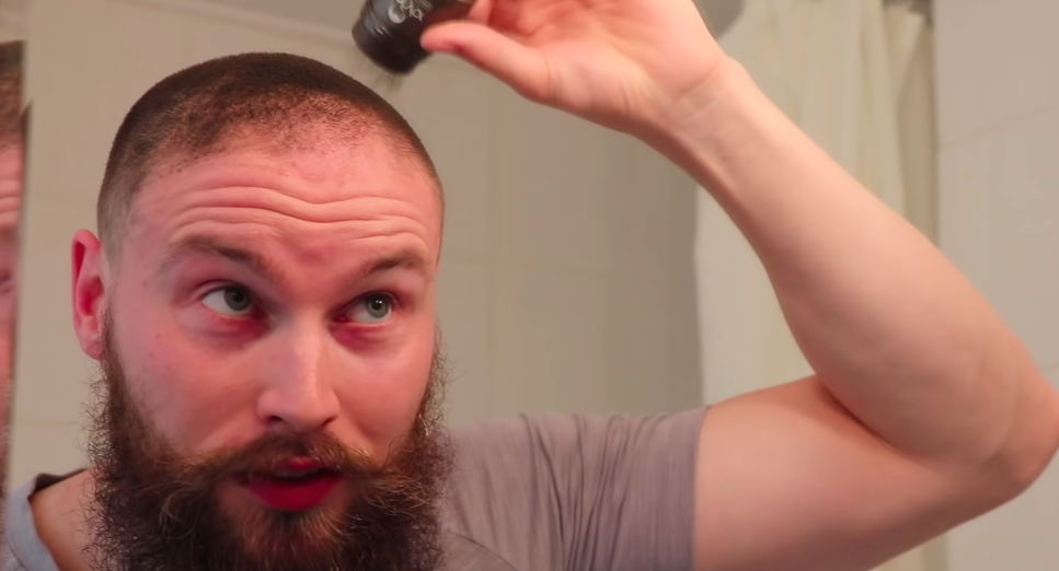 This Guy Tested Hair Fibers to Try and Cover Up His Bald Spot
