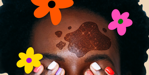 woman with hyperpigmentation surrounded by illustrated flowers
