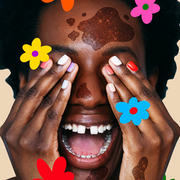 woman with hyperpigmentation surrounded by illustrated flowers