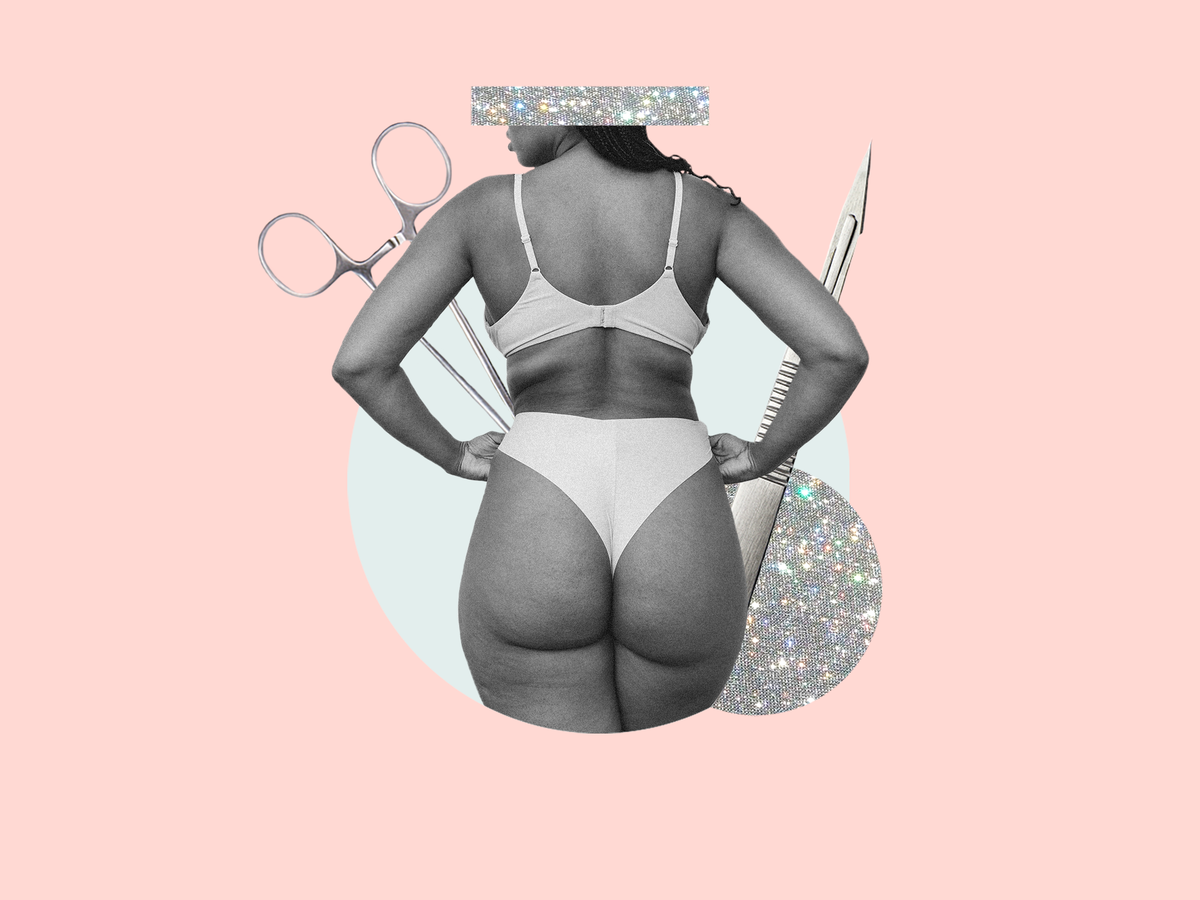 Brazilian Butt Lift: what is a BBL and how much does it cost?