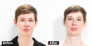 Jessie Van Amburg glycolic peel before and after