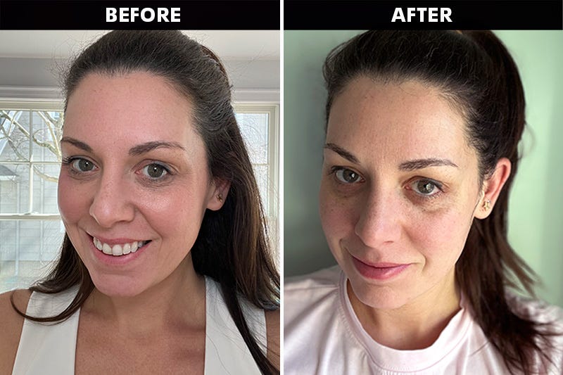 comparison of two images showing the effects of a beauty treatment