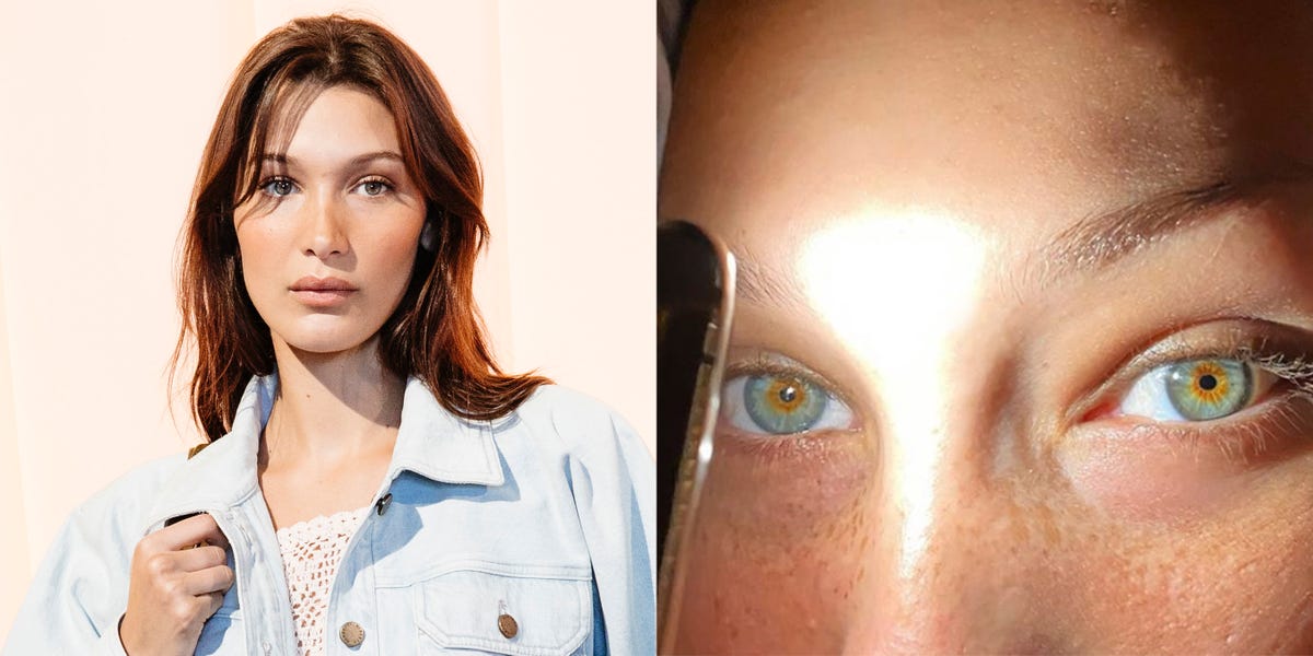 Bella Hadid Shares Makeup-Free, Just Woke Up Selfie on Instagram