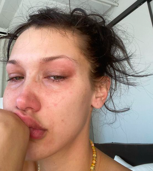 bella hadid says going to therapy had a 'domino effect'
