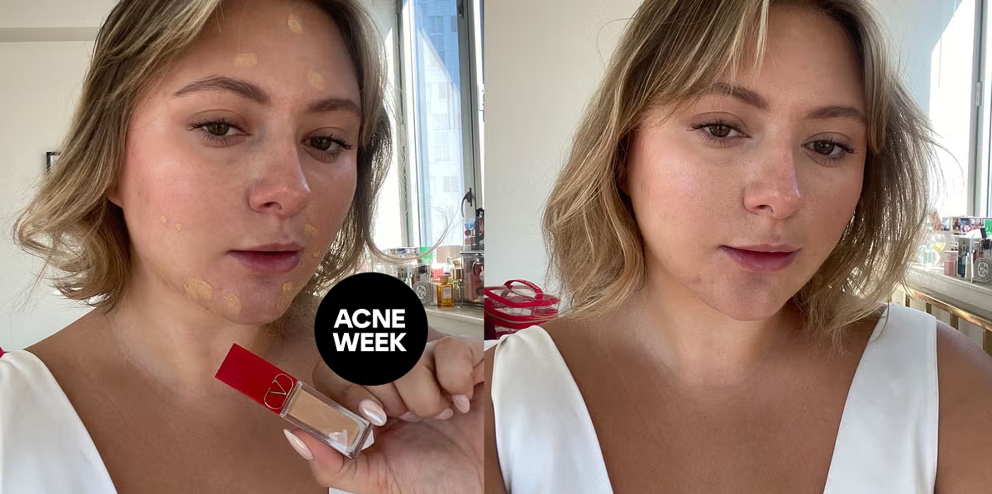 19 Best Concealers for Acne 2024 Tested and Reviewed
