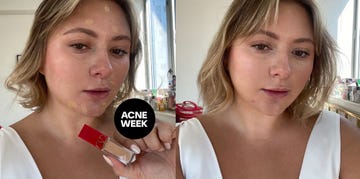 acne concealer