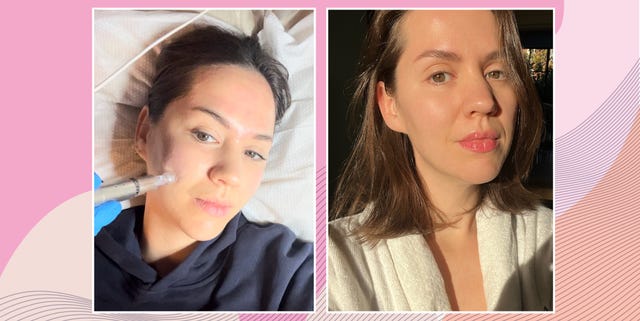 I'm a skincare pro nurse - I tried 's TikTok viral anti-aging