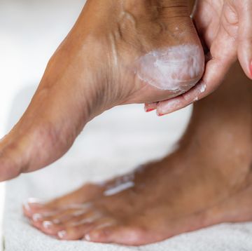 woman rubbing cream into foot
