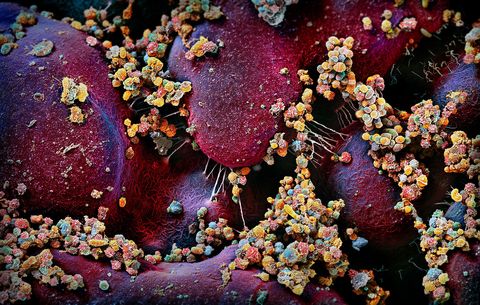 In het januarinummer van 2020 onderzocht National Geographichoe de biljoenen microben die in en op ons leven ons benvloeden Op dit drukke plaatje is een kolonie van microben te zien die afkomstig zijn van de lippen van een vrouw Als mensen elkaar vaak zoenen gaat hun orale microbioom op dat van de ander lijken