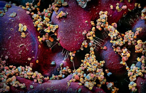 https://www.nationalgeographic.com/content/dam/science/2020/12/04/best2020/best2020-05.jpg In het januarinummer van 2020 onderzocht National Geographichoe de biljoenen microben die in en op ons leven ons benvloeden Op dit drukke plaatje is een kolonie van microben te zien die afkomstig zijn van de lippen van een vrouw Als mensen elkaar vaak zoenen gaat hun orale microbioom op dat van de ander lijken