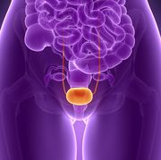 bladder cancer symptoms in women