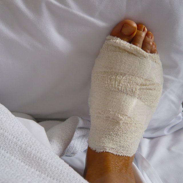 bandaged foot 