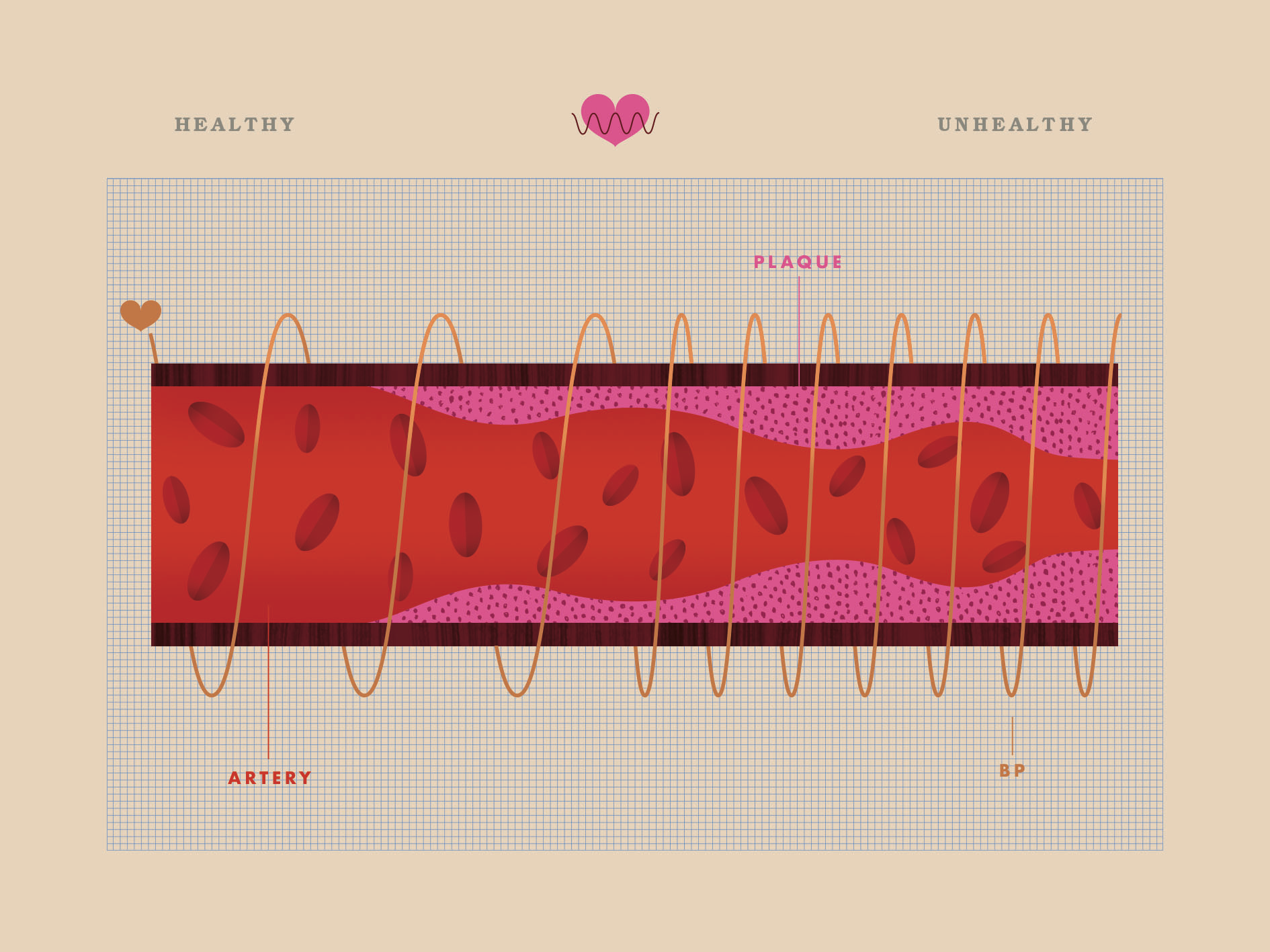The Easiest Way to Understand Your Blood Pressure