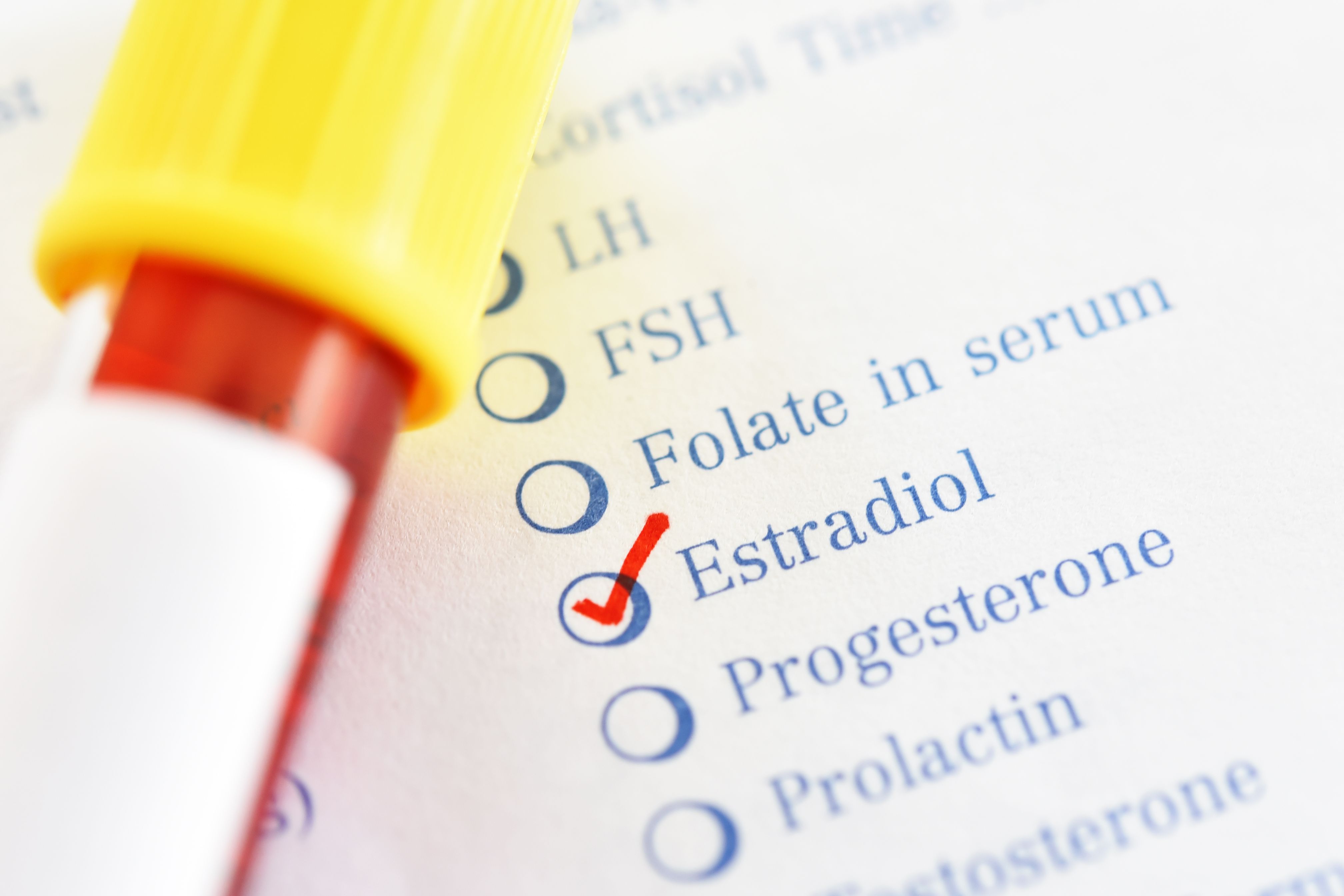 blood sample for estradiol hormone test