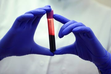 blood sample