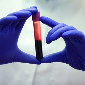 Blood Sample blood sample