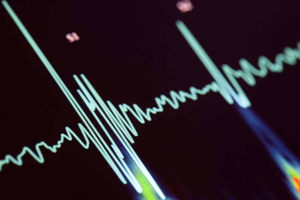 A blue heartbeat trace on a screen