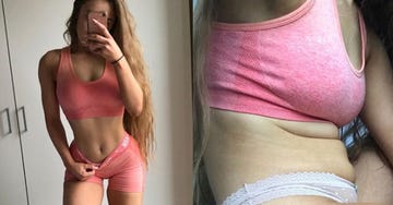 Cellulite Instagram