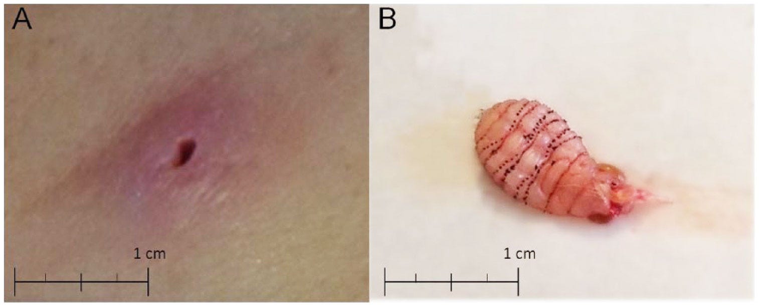 Bloatfly larva