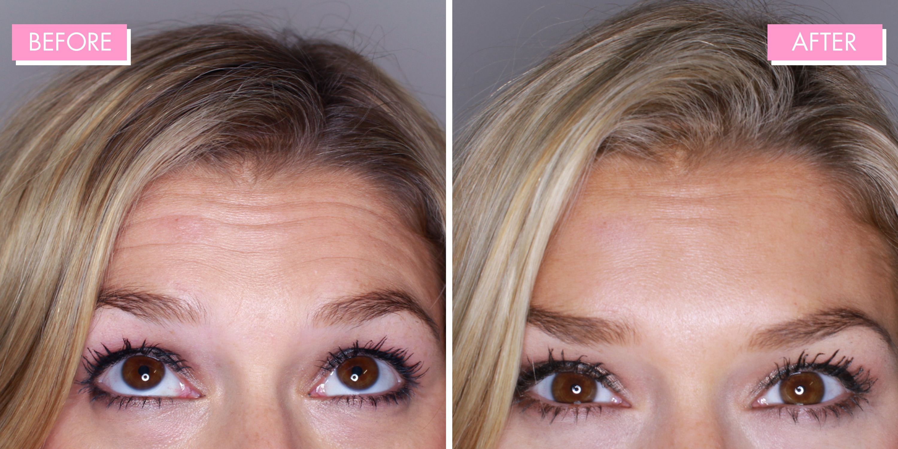 Hair Botox Review NonChemical Smoothing Treatment