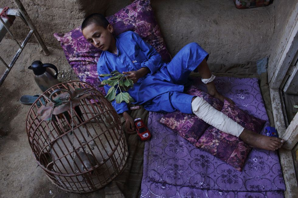 Jamshid ligt op een stel kussens en speelt met een patrijs thuis in zijn dorpje Qualander Khel op twee uur rijden ten noorden van Kaboel Jamshid en zijn twee vriendjes raakten ernstig gewond en zijn 18jarige broer werd gedood toen een zelfmoordterrorist in augustus 2014 dichtbij zijn huis een konvooi van de NAVO aanviel