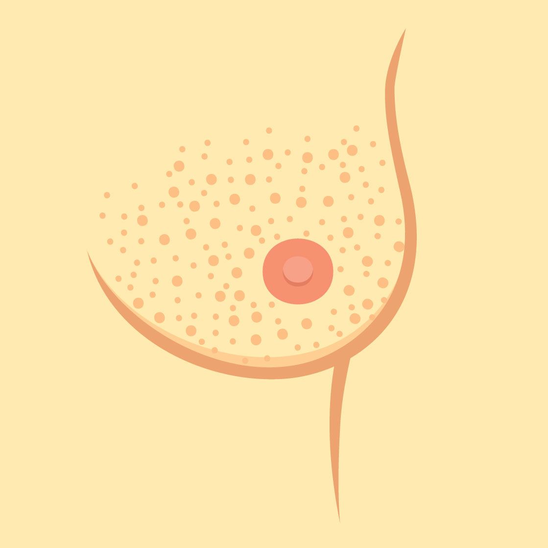 Breast Texture changes