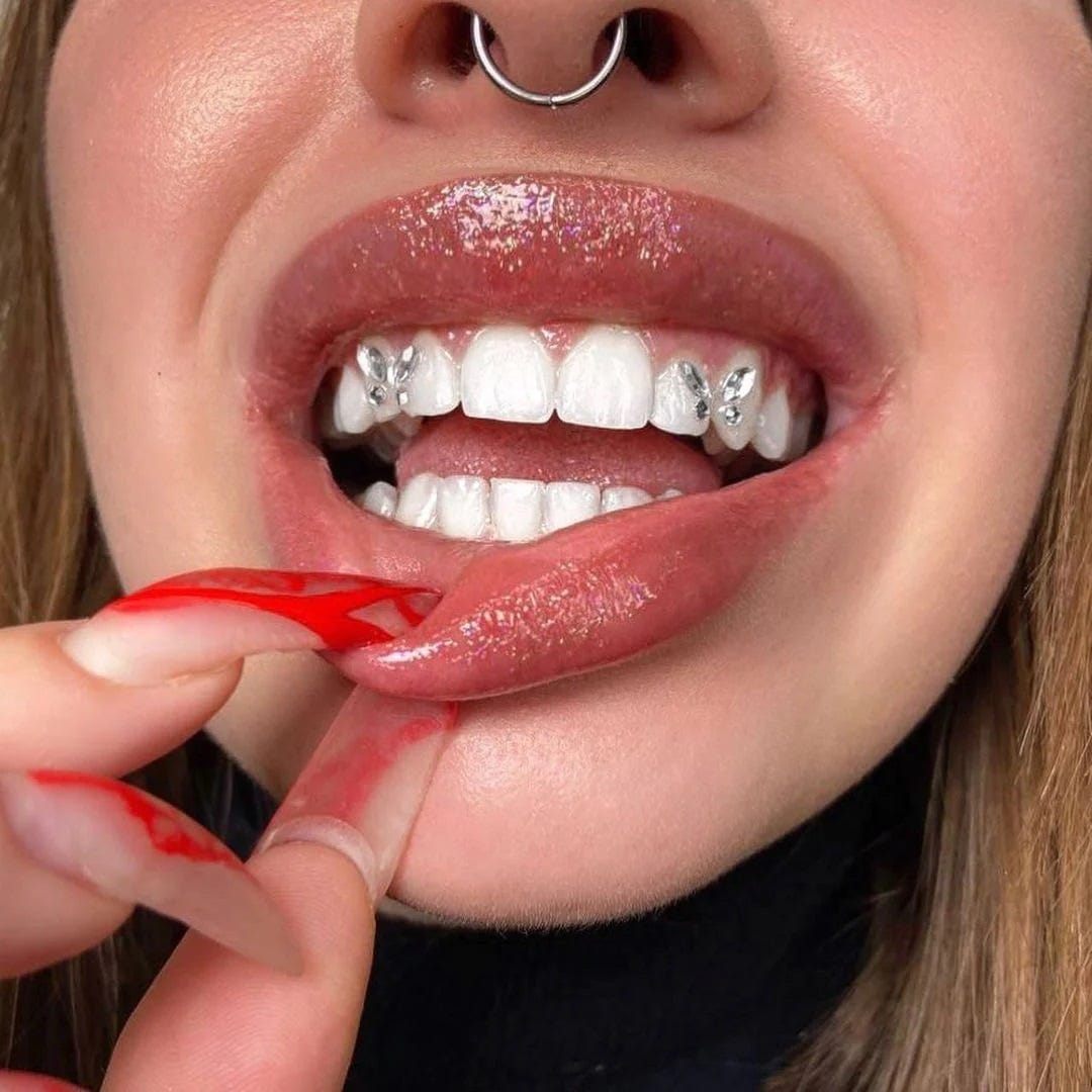 Brillantini sui denti e tooth gems, la nuova mania delle star Foto