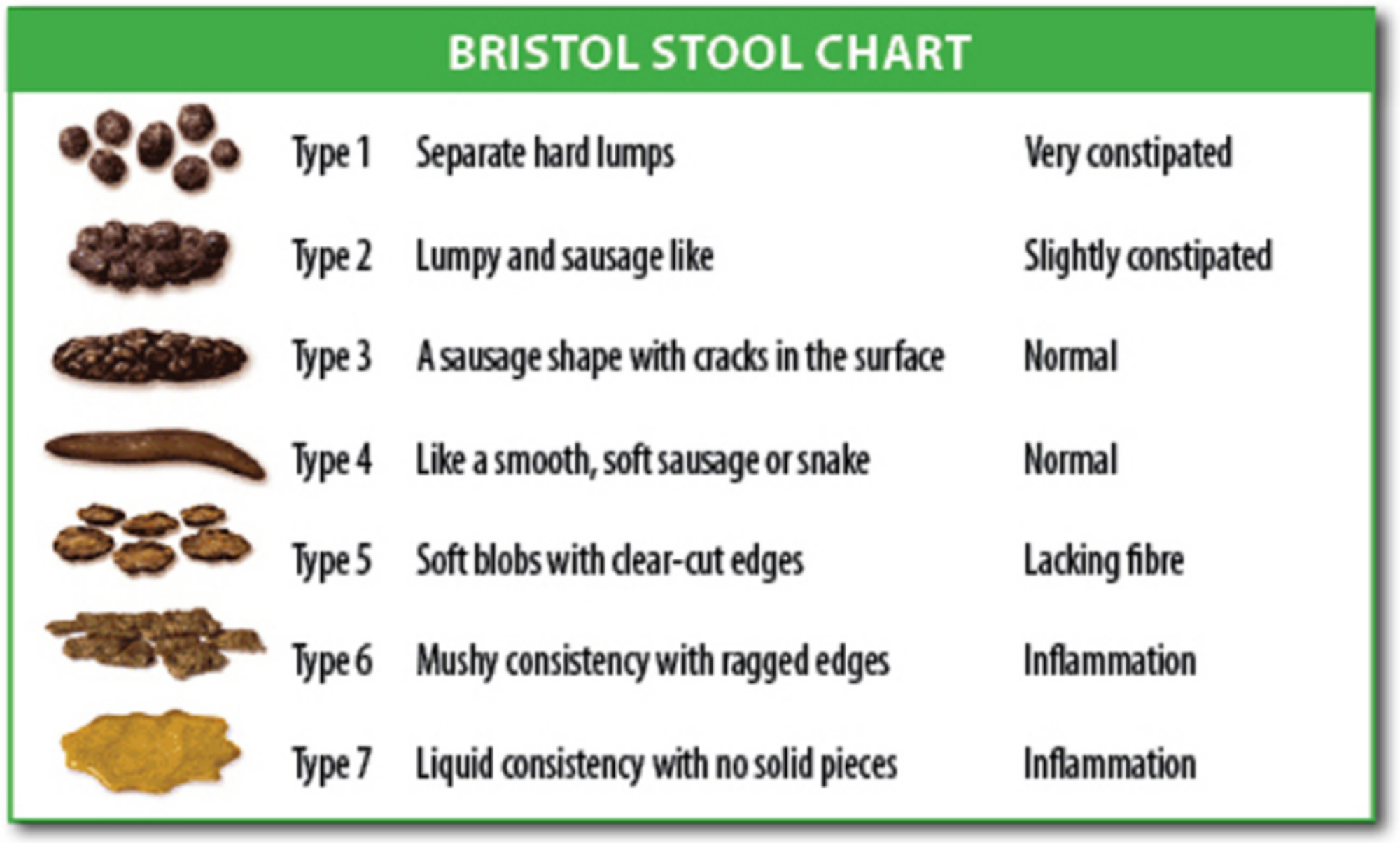 Bristol Stool Chart: Types Of Poop And What They Mean, 41% OFF